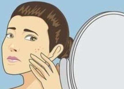 激光去痘印前的注意事項(xiàng)