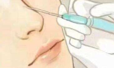 看看注射玻尿酸的副作用有哪些？