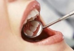 什么是牙結(jié)石？牙結(jié)石有什么危害？