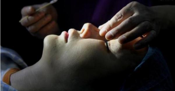 整形術(shù)后的注意事項(xiàng)