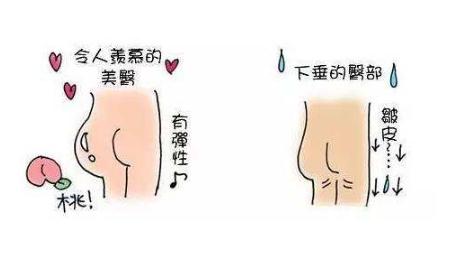 假體豐臀適合哪類人群？