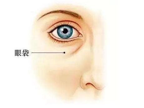 抽脂去眼袋后皮膚變松弛，有什么補(bǔ)救措施？