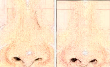 術(shù)后護(hù)理