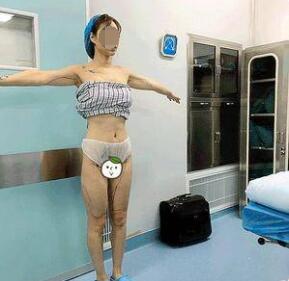 大腿吸脂術(shù)前