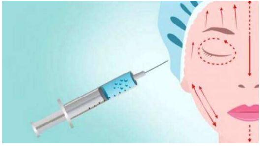 上了30歲打玻尿酸皮膚容易變松弛嗎?