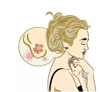 瘢痕疙瘩的調(diào)節(jié)方法