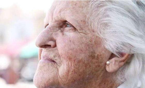 激光調(diào)節(jié)老年斑的方法簡直是方便又省錢！