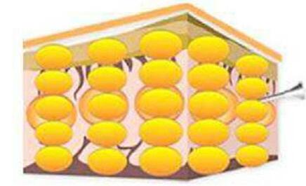 面部脂肪填充過量，按壓和吸脂可以解決這個問題嗎?