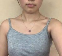 3萬塊錢做的抽脂豐胸怎么樣？來看看我的果圖