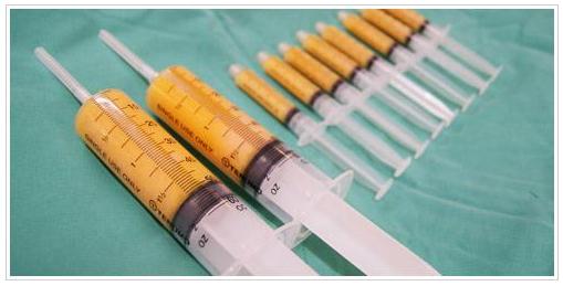 自體脂肪隆鼻的相關(guān)介紹~快來(lái)漲姿勢(shì)吧！