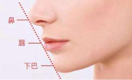 玻尿酸注射鼻頭、延長(zhǎng)鼻小柱的果