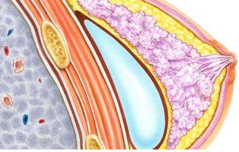 和注射隆胸的醫(yī)生有關(guān)