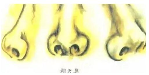 鼻孔外露手捏就能解決？還是手術(shù)比較靠譜！