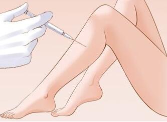 小腿抽脂的優(yōu)勢