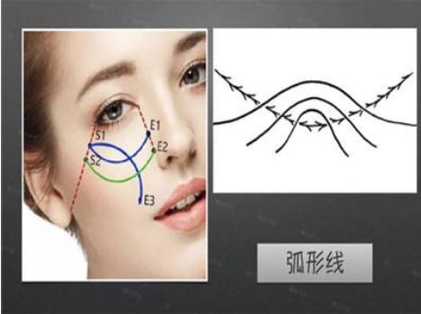 做面部提升術需要多少錢?