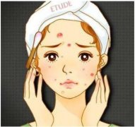 做果酸換膚醫(yī)美項(xiàng)目是多少錢一次？