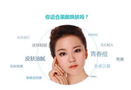 果酸換膚一次有果嗎？