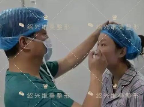 紹興維美整形做的祛斑+瘦臉+雙眼皮手術術前