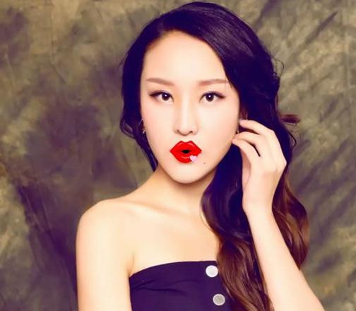 紹興維美整形做的祛斑+瘦臉+雙眼皮手術術后三個月