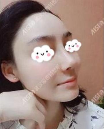 術(shù)后恢復(fù)