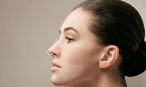 朝天鼻整容手術(shù)