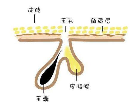 什么是黑頭？