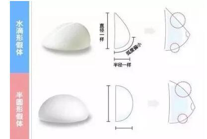 假體隆乳術的預防措施