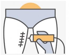 想要了解抽脂減肥價格一覽表？傾情奉上！