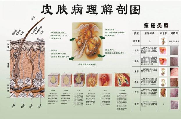 下巴痘痘反復(fù)生長的原因具體是什么？