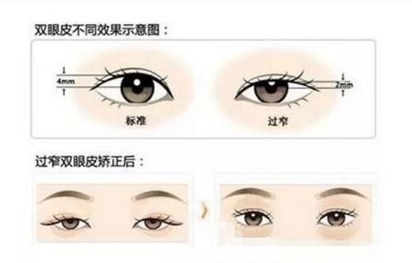 張鋒醫(yī)生擅長項目