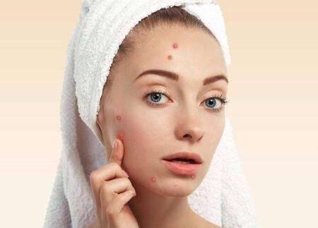 激光調(diào)節(jié)后痤瘡會復(fù)發(fā)嗎?