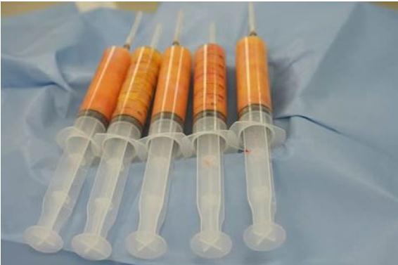 跟受術(shù)者選擇的醫(yī)院、醫(yī)生有關(guān)