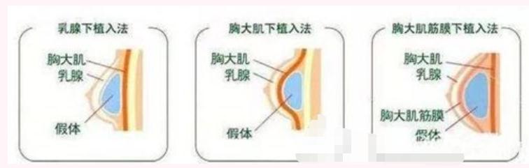 擅長項(xiàng)目