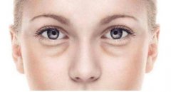 小編帶你了解眼袋抽脂術(shù)的原理，輕松解決眼袋