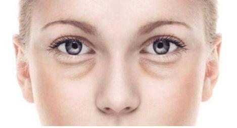 小編帶你了解眼袋抽脂術(shù)的原理，輕松解決眼袋