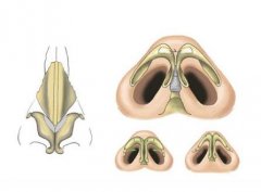 鼻頭縮小手術價格費用，醫(yī)院收費詳情！