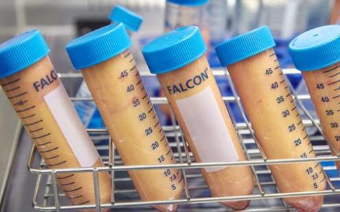 自體脂肪墊下巴的果能夠維持多長時(shí)間?