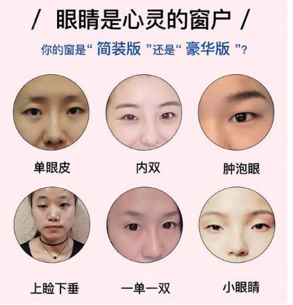 眼部手術(shù)一般多少錢?