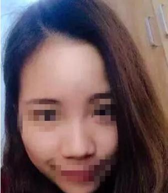 長(zhǎng)春假體隆鼻手術(shù)術(shù)前