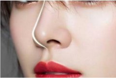 做線-雕隆鼻大概是多少錢？收費標準是怎樣的？