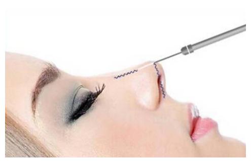 什么是************？