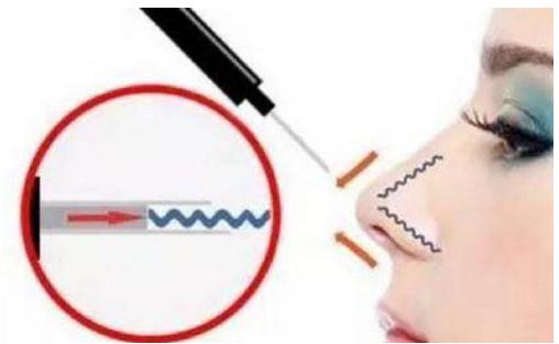 什么是************？