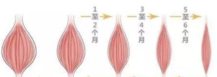 注射瘦臉副作用