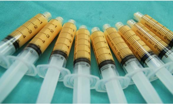 自體脂肪豐額的危害