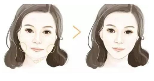 國產(chǎn)*********和美國BOTOX分別是多少錢一針?