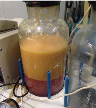 大腿吸脂能保持多久？