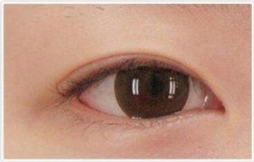 開眼角有什么害處?