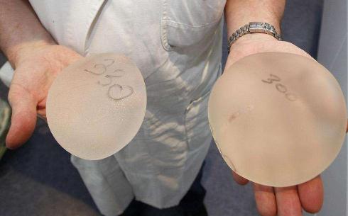 隆胸手術(shù)的假體可以終生不換取嗎？