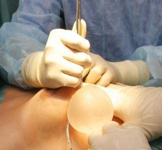 隆胸手術(shù)的假體可以終生不換取嗎？