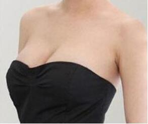 　假體隆胸的注意事項(xiàng)